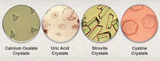Types Of Crystals In Urine