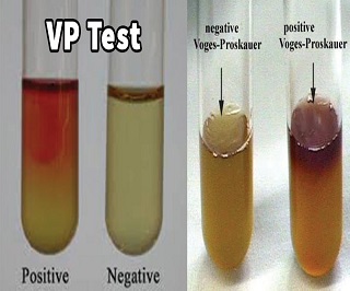 Voges Proskauer (VP) Test